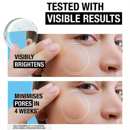Neutrogena Hydro Boost 10% Niacinamide Serum 30ML