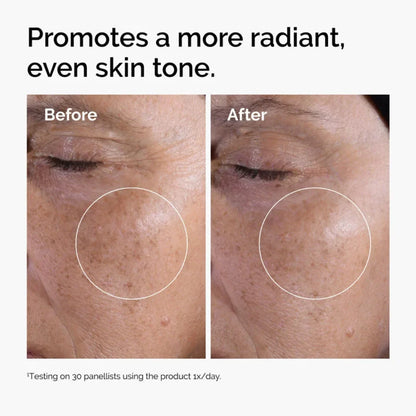 The Ordinary Glycolic Acid 7% Exfoliating And Brightening Toner