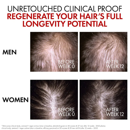 VICHY Aminexil Clinical R.E.G.E.N. Hair Renewing Serum 90ML