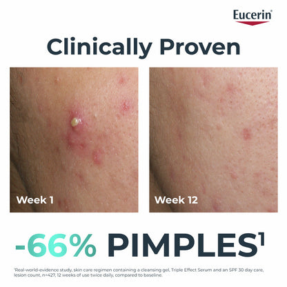 Eucerin DermoPure Clinical Triple Action  40ML